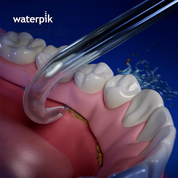 Waterpik™ Implant Denture Tip – (DT-100E) - Image 3