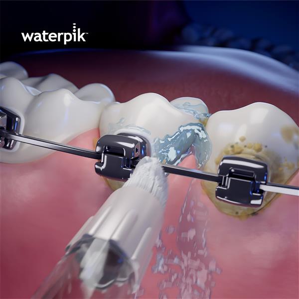 Waterpik™ Whitening Water Flosser – Orthodontic Tip – (WOD-2E) - Image 3