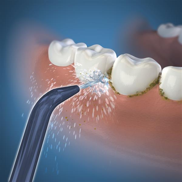 Waterpik™ Handheld Cordless Precision Low-Flow Tip – (JT-360E) - Image 3